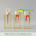 EN-N8 Differing Degree Curvature Inside Root Canals Transparent Block S4